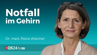 Gefahr im Gehirn Alles was Sie über den Schlaganfall wissen müssen  Visite  QS24 [upl. by Gnek570]