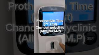 Prothrombin Time PT Test laboratory pathology bloodtests [upl. by Harneen367]