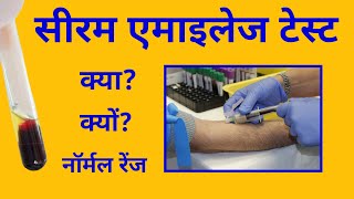 सीरम एमाइलेज टेस्ट Amylase test एमाइलेज़ की नॉर्मल रेंज amylase normal range [upl. by Karola145]