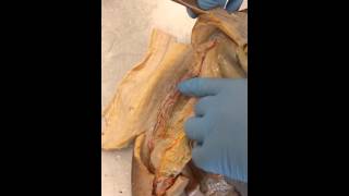 Urogenital system of female dogfish shark [upl. by Kirkwood300]