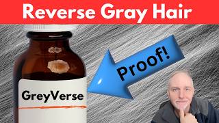 GreyVerse Real Gray Hair Solution Proof ‼️ [upl. by Bette]