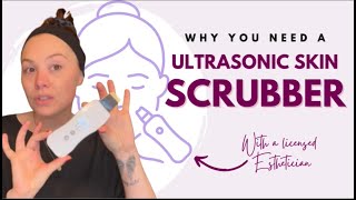 Get Glowing Skin with Ultrasonic Scrubber Estheticians Guide [upl. by Johnstone]