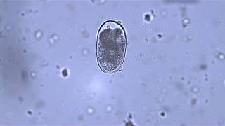 Uncinaria stenocephala canine hookworm 4x 10x and 40x [upl. by Luca]