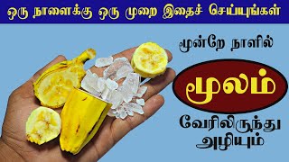 இது பைல்ஸ் என்னும் மூல நோயை வேரோடு அறுக்கும்  piles home remedy tamil [upl. by Fried]