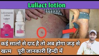 Luliact lotion use dose benefits and Side effects full review in hindiluliconazole1lotion [upl. by Ruthie697]