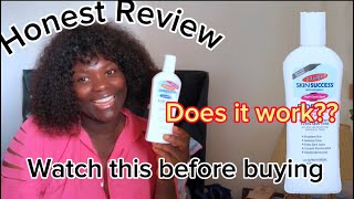 PALMER’S SKIN SUCCESS FADE MILK HONEST REVIEW  WATCH THIS BEFORE BUYING [upl. by Llenel858]