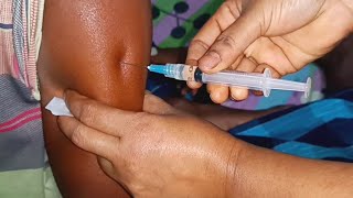 IM Intramuscular Arm injection Push Ketorolac  Xerokit  injection Ep 42 Injection Vision [upl. by Ahtel200]