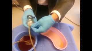 How to empty a surgery drain [upl. by Cressida]