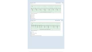 Relias Dysrhythmia Basic Test Answers 2023 Dysrhythmia – Basic A Questions and Answers [upl. by Irrak]