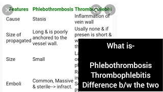 Phlebothrombosis Thrombophlebitis Pathology Second year mbbs [upl. by Bobseine]