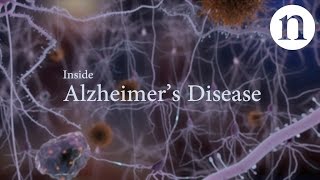 Inside Alzheimer’s disease [upl. by Haldeman]