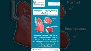 What is a emphysemaemphysemaempyemapneumothoraxhydrothoraxhemothoraxpyothorax [upl. by Alithea]