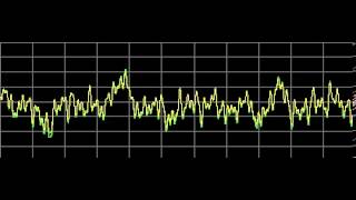 Candidiasis Candida Albicans  Rife Frequencies [upl. by Obbard]