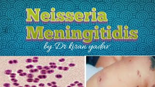 Microbiology lectureNeisseria Meningitidis  disease symptoms pathogenesisdiagnosis treatment [upl. by Joab145]