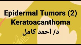 2 keratoacanthoma [upl. by Teemus]