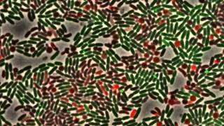 Dueling between green Pseudomonas aeruginosa cells ClpVGFP and killing of [upl. by Muhcan74]