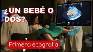 PRIMERA ECOGRAFÍA 6 SEMANAS EMBARAZO  Latido cardiaco ¿Un bebé o dos ¿GEMELOS [upl. by Ennairrac386]