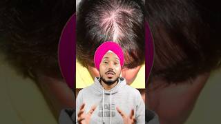 Jatamansi Hair Growth Remedy Natural Solution for Stronger Roots amp Regrowth reducehairfall [upl. by Ahtamat]