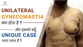 Unilateral Gynecomastia kya hota hai aur isko kyu unique case maana jata hai Gynecomastia ka [upl. by Alusru]