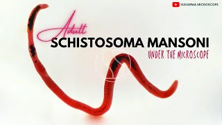 Adult Schistosoma mansoni under the microscope [upl. by Etienne]