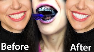 Fastest Way To Whiten Teeth At Home What REALLY Works [upl. by Leavy]