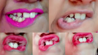 Lip bite challengelip bite kiss tutoriallip challengefunny lip bite challenge funwithpapia [upl. by Innek156]