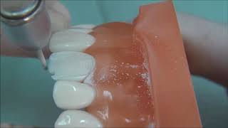 All ceramic crown tooth preparation for dental students [upl. by Malcolm]