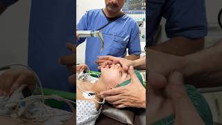 Colostomy reversal Under General Anesthesia shortvideo youtubeshorts [upl. by Theda]