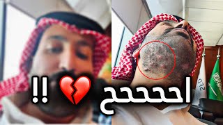 💈 انتبهوا من الحلاقين ⚠️ [upl. by Kablesh476]