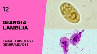 Giardia Lamblia 12  Giardiasis  Parasitología  Flagelados [upl. by Kimble]