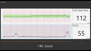 Fetal Heart Monitoring [upl. by Aihsit375]