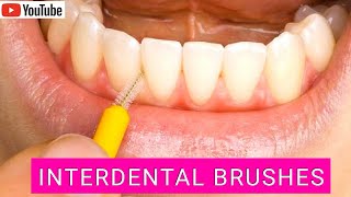 How to Use Interdental Brushes Correctly Top Tips [upl. by Dekow]