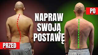 NAPRAW swoją POSTURĘ raz na Zawsze Na przykładzie Jarka [upl. by Mussman]