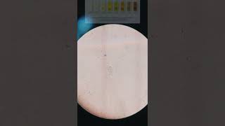 🎥Trichomoniasis Trichomonas in urine under 🎥📲Microscope Its Symptoms and sign With treatment [upl. by Ulda408]