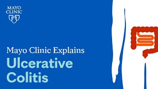 Mayo Clinic Explains Ulcerative Colitis [upl. by Delanos]