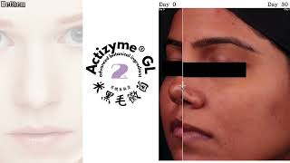 Actizyme® GL advanced botanical ingredient [upl. by Ydnyc]