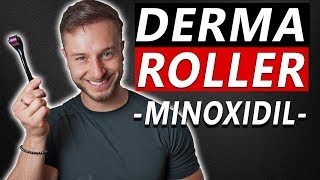 How To Use Derma Roller and Minoxidil to Regrow Hair [upl. by Cown]