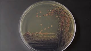 Colors  Bacterial Pigments TimeLapse [upl. by Goodden]