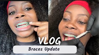 Braces Appointment Its the end of this braces journey  Progress check Vlog adultbraces [upl. by Adina88]