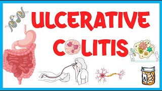 Ulcerative Colitis Causes Risk Factors Pathogenesis Clinical Presentation Diagnosis amp Treatment [upl. by Atorod989]