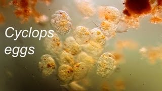 Copepod eggs [upl. by Belac]