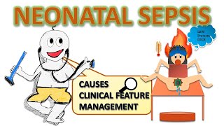 Neonatal sepsis risk factors septic screening  management etc NEONATOLOGY SERIES CH4 [upl. by Newra443]