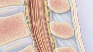 Comment pratiquer une ponction lombaire [upl. by Tiertza]