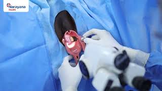 Basics of Colposcopy Procedure [upl. by Norreg922]