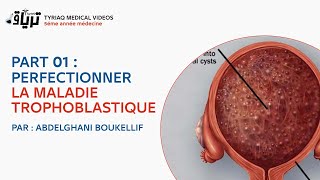 PART 01 PERFECTIONNER LA MALADIE TROPHOBLASTIQUE  mole hydatiforme   PAR  ABDELGHANI BOUKELLIF [upl. by Thia381]