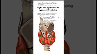 Signs and symptoms of hypoparathyroidism [upl. by Aube]