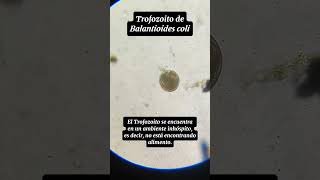 Trofozoito y Quiste de Balantioides coli Antiguamente conocido como Balantidium coli [upl. by Gerhardine]