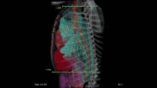 Collimating Thorax Radiographs in Small Animal Veterinary Radiology [upl. by Nerra]