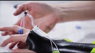 Dorsal wrist orthosis Orfilight Black with Orfitube outrigger  Splinting techniques 810 [upl. by Fowkes849]