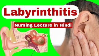 Labyrinthitis  causes symptoms management  medical surgical nursing  nursing lecture in hindi [upl. by Rosamond]